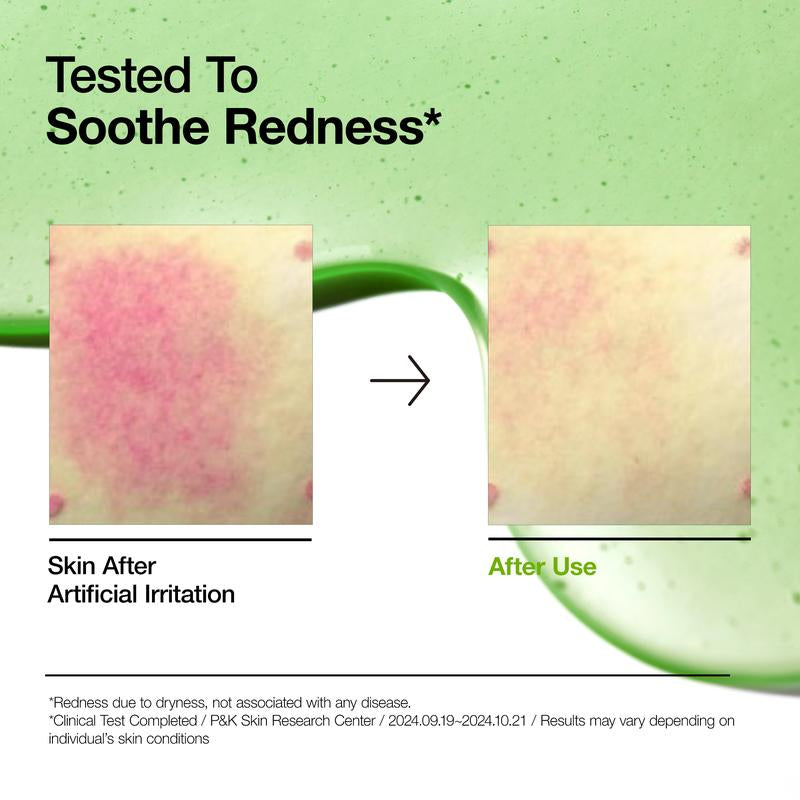 [Anua Official Shop] Azelaic Acid 10 Hyaluron Redness Soothing Serum 1.01 Fl.Oz.(30Ml)｜Azelaicacid, Hyaluronic Acid, Non-Poreclogging, Korean Skincare, Soothing, Redness, Sensitive Skin, Acne-Prone