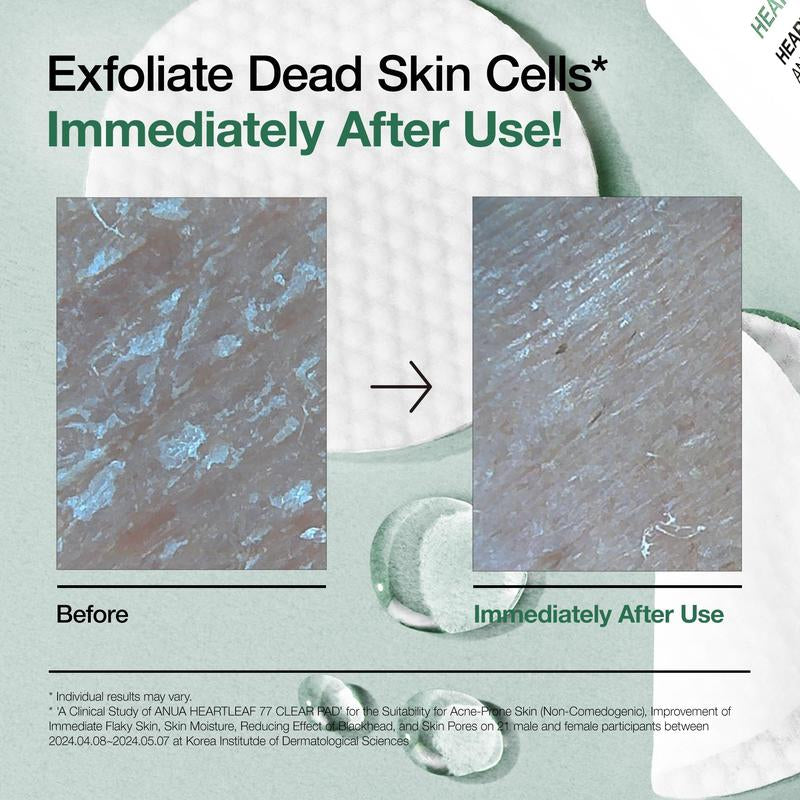 [Anua Official Shop] Heartleaf 77 Toner Pad 70 Sheets with PHA 6.93 Fl.Oz. (205Ml)｜Non-Comedogenic, Mild, Korean Skincare, Skincare Comfort, Smooth Exfoliate, Daily, Gentle, Soothing